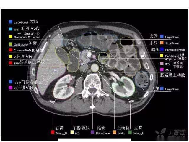 胰腺ct断层解剖图片