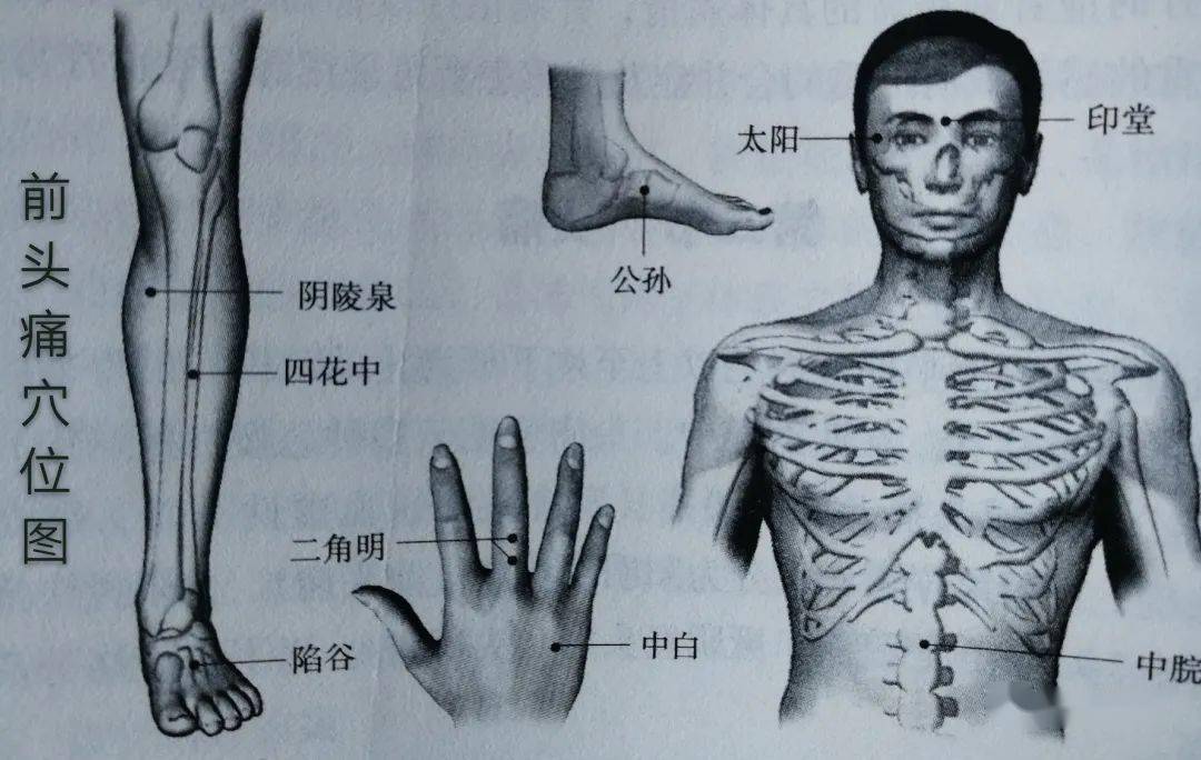 谢氏拔罐临床治疗头痛验集