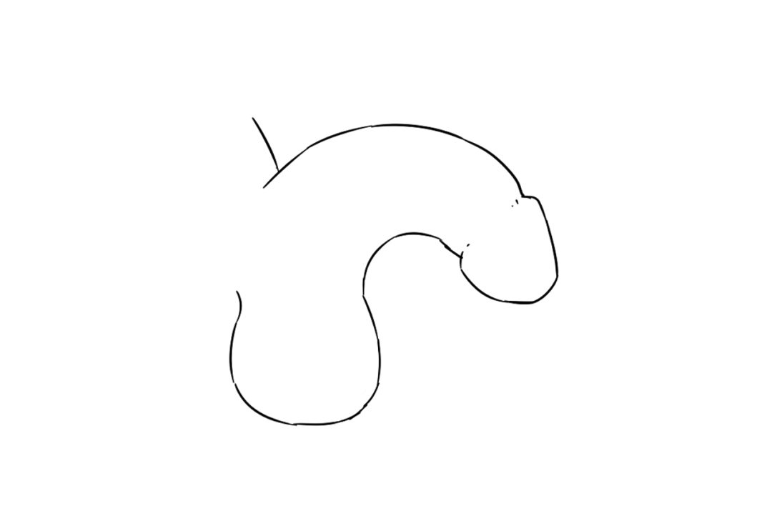 妈妈快捏一下宝宝小丁丁这个幼儿高发病发现迟了抱孙子都难