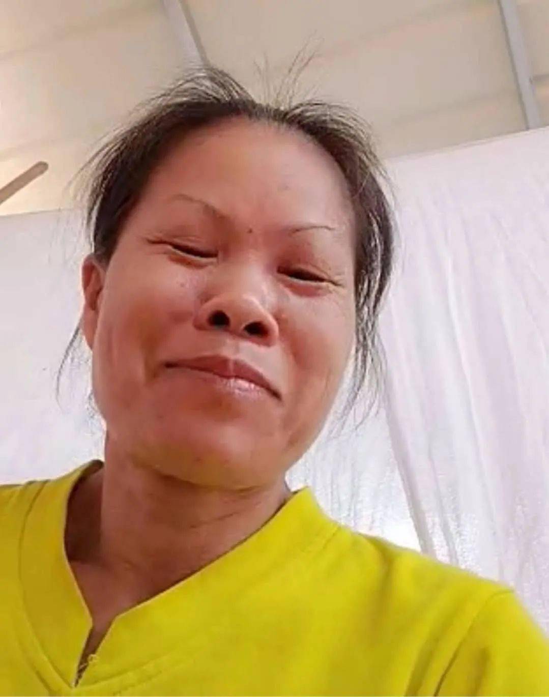 黄美芬,女,51岁,身高1.