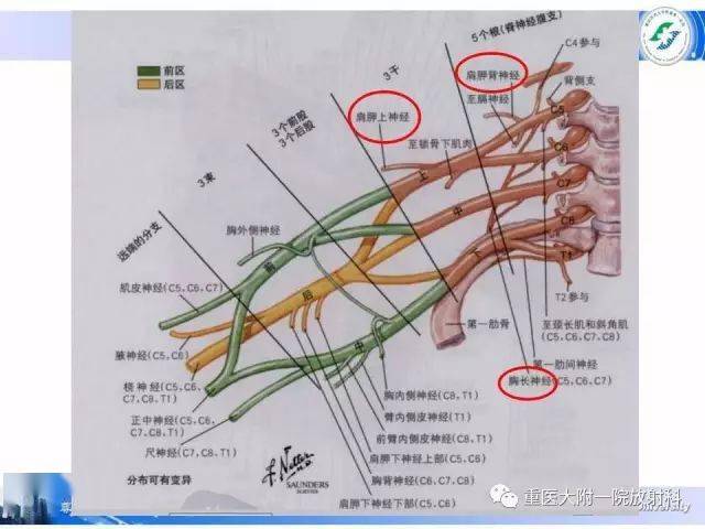 臂丛神经病变的影像学诊断