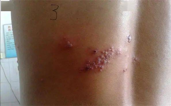 胆囊炎,胆石症等,多与进食有规律性 ,伴有反酸,烧心,反胃等症状 ,这就