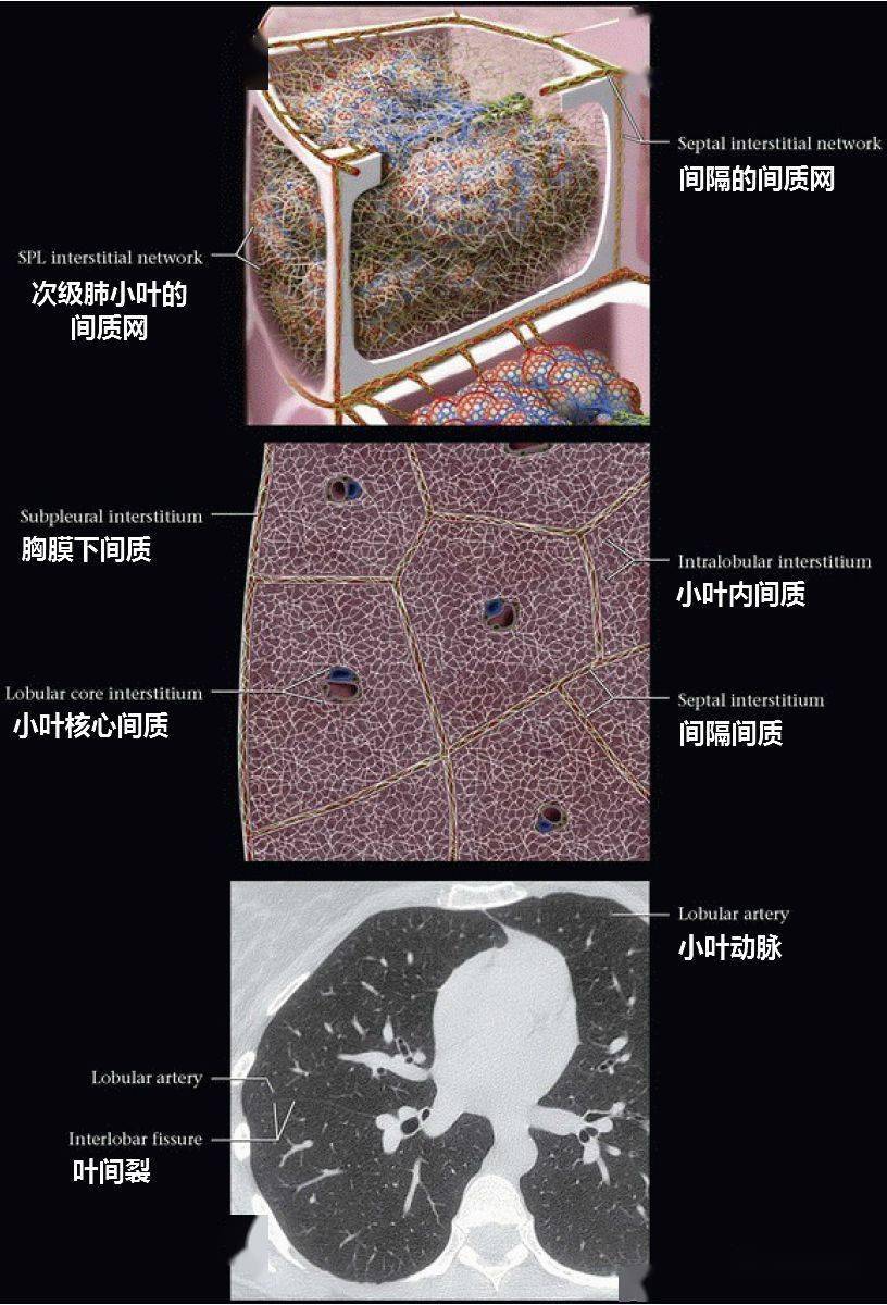 肺泡间隔图片图片