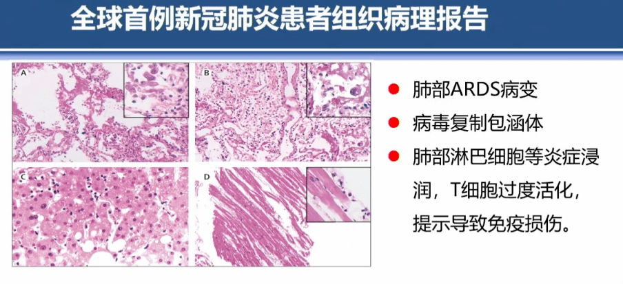 67第十三届中国生物产业大会王福生院士干细胞治疗新