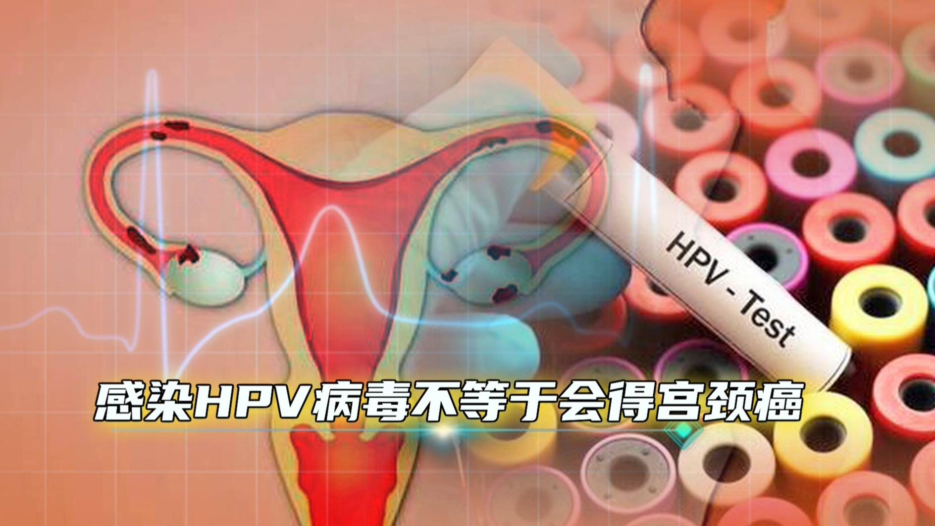 扁平疣與宮頸癌都是hpv病毒感染導致的長了扁平疣宮頸癌就來了速看