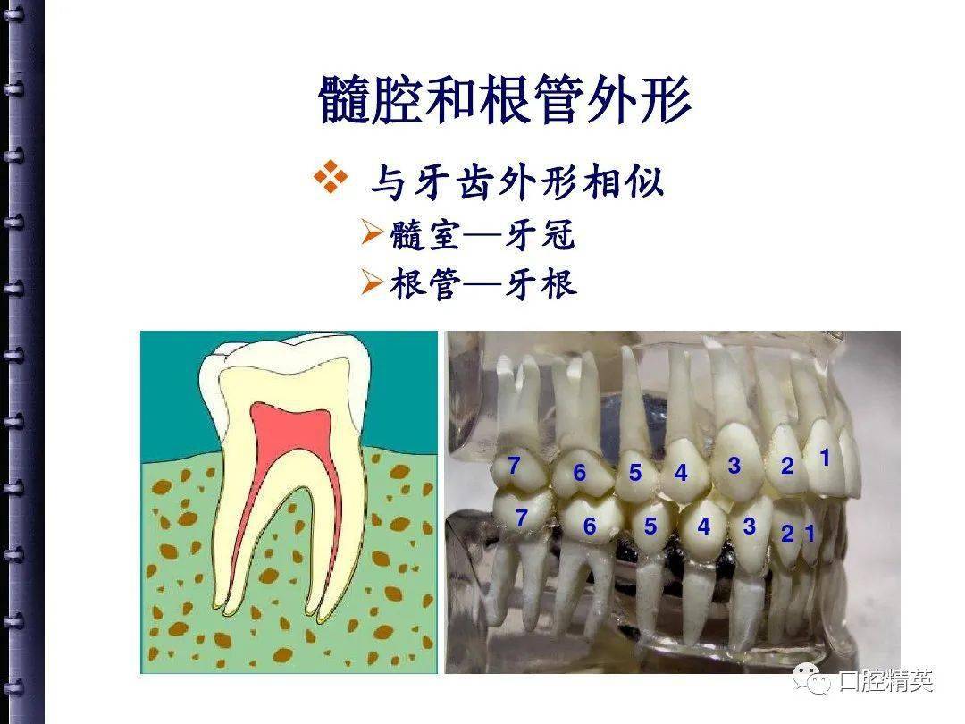 根管治疗的步骤方法器械
