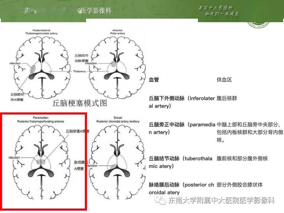 解剖| 頭部血管解剖及willis環常見變異