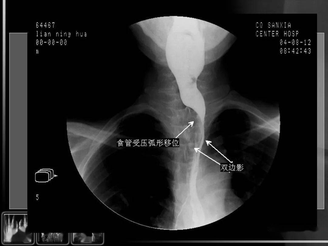 牛角胃图片