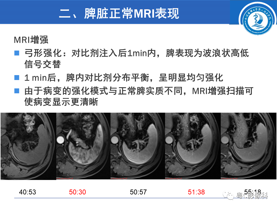 正常脾組織和腫瘤組織的弛豫時間相近mr平掃不容易發現脾臟局灶性病變