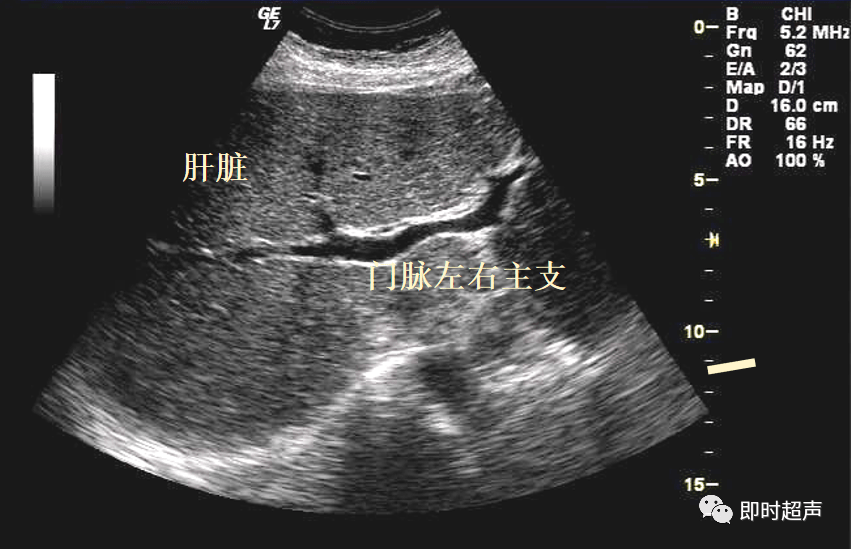 肝脏胆道系统解剖