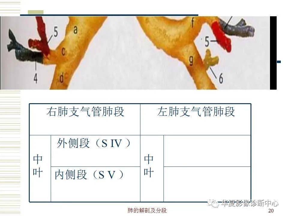 羊肺示意图图片