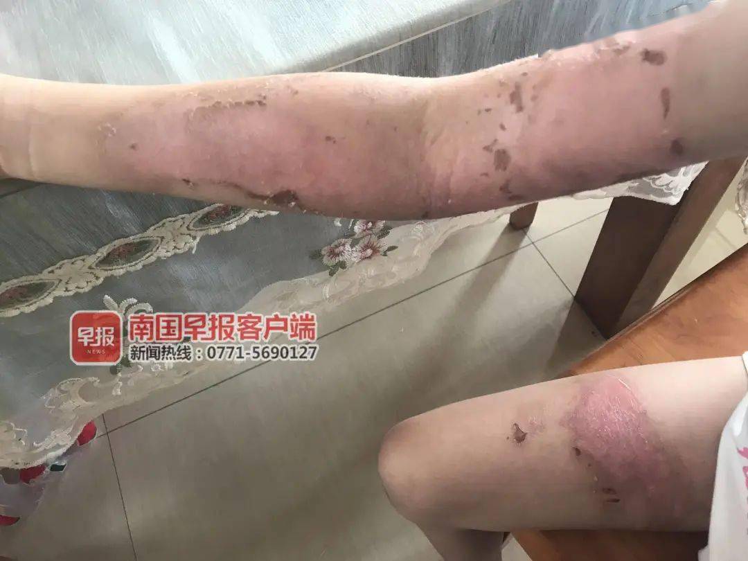 斯里兰卡中死去的女尸图片