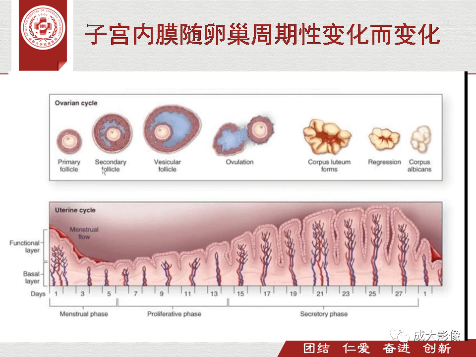 超讚子宮mr掃描規範正常表現及子宮內膜癌的分期