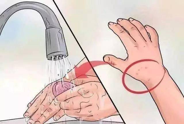 如果现场有条件,可以使用碘伏或者碘酒,酒精,对伤口进行消毒.