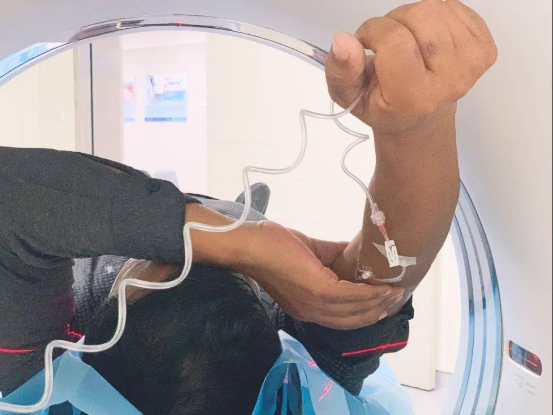 增强ct和普通ct的区别大多数人都不知道