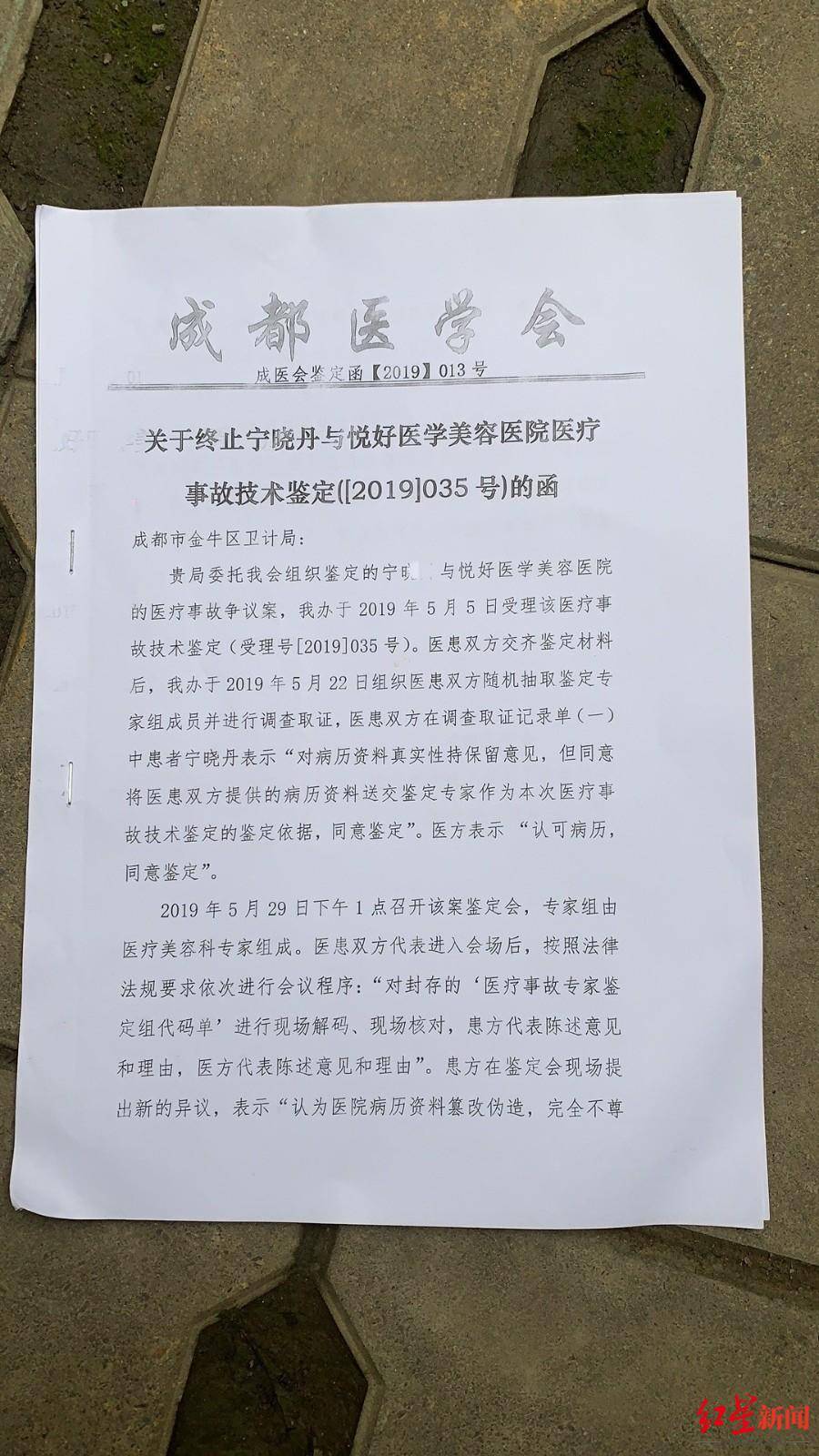 恒达官网整形悲剧:“成都赵丽颖”没当成,鼻子还变形 院方:手术确实出了问题 (图10) 恒达官网整形悲剧:“成都赵丽颖”没当成,鼻子还变形 院方:手术确实出了问题 (图10)