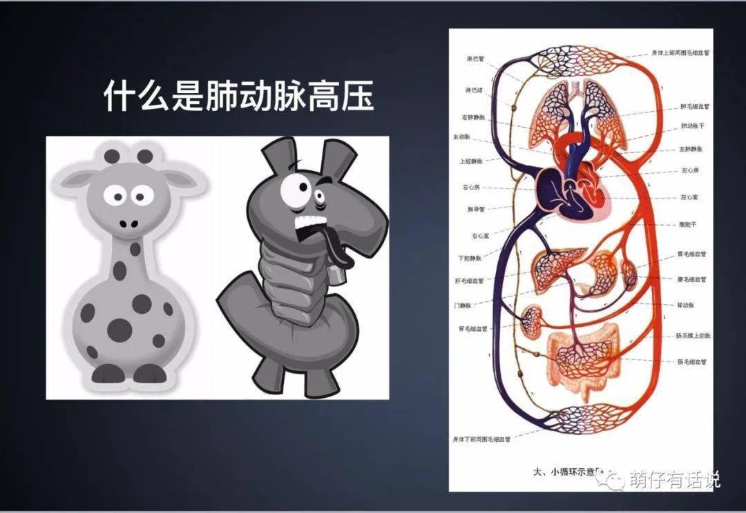 重疾条款原发性肺动脉高压肺心病疾病且状态