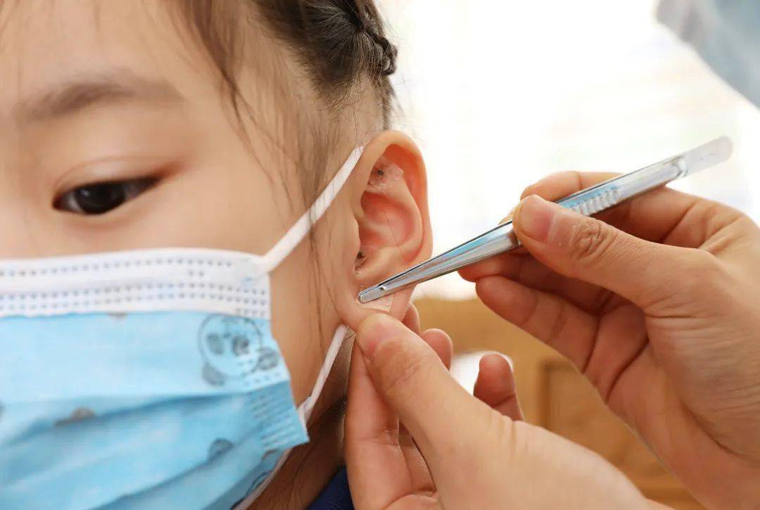 这一中医疗法让近视的孩子看清世界