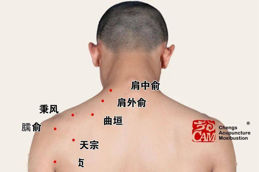 乳房胀痛拔罐位置图片图片