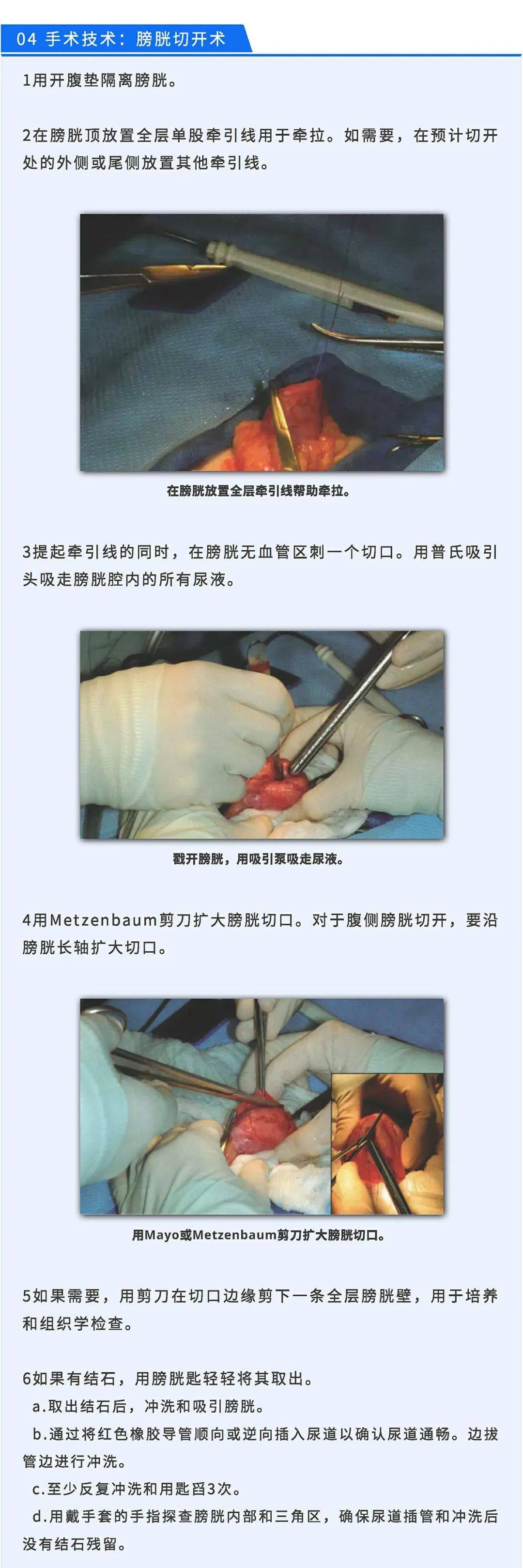 女性膀胱手术切开图片