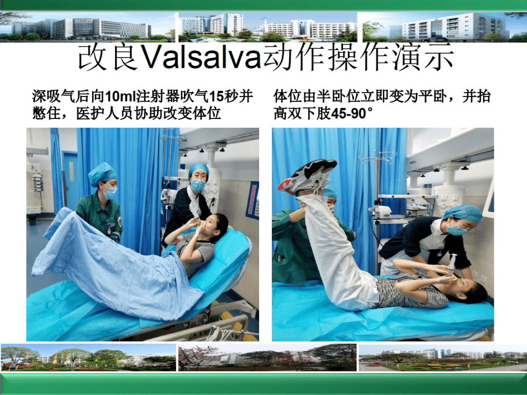 改良valsalva动作图解图片