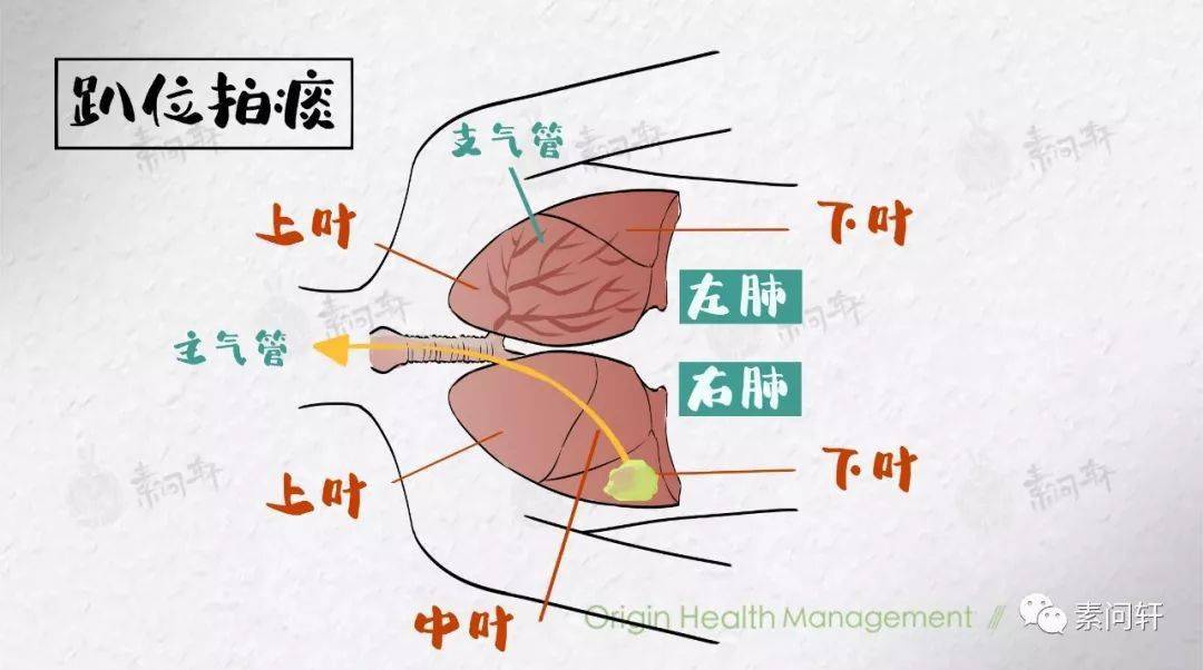 素問程醫生孩子有痰咳不出怎麼辦家長必備的拍痰技巧趕緊收藏