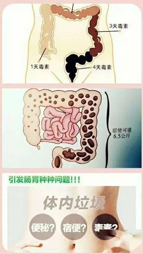 商卡排毒肠道清洁术开始报名啦