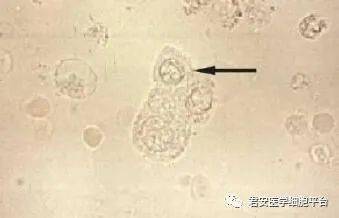 请报告图片中箭头所指物的名称白细胞点击空白处查看答案请报告图片中