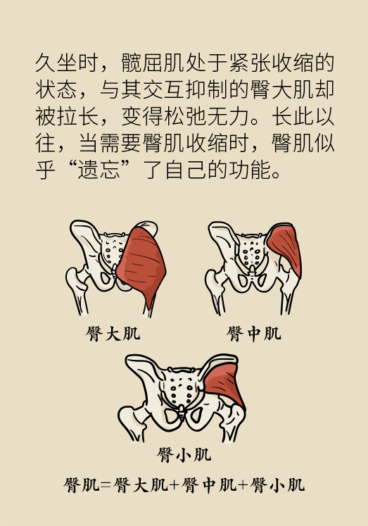 每天久坐超过6个小时?小心患上死屁股综合症