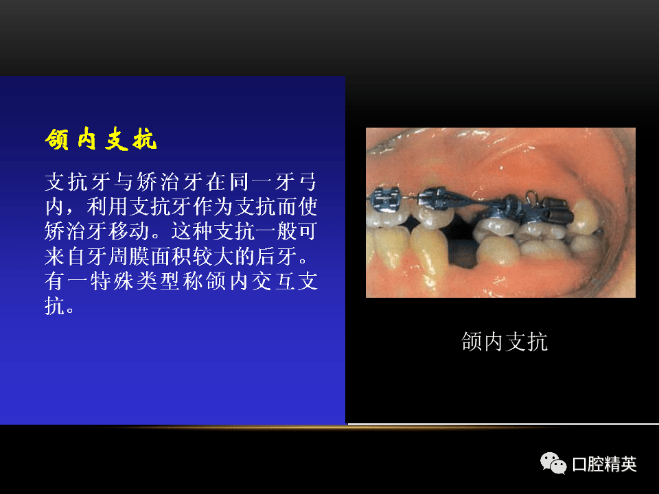 正畸治疗中的支抗控制