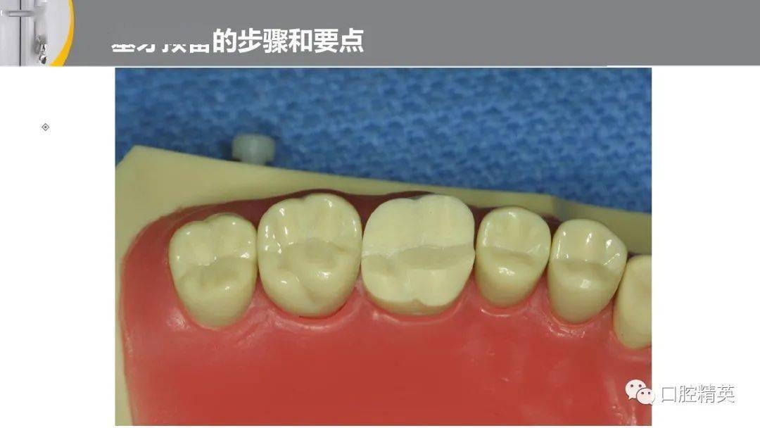 全冠的牙体预备前后牙