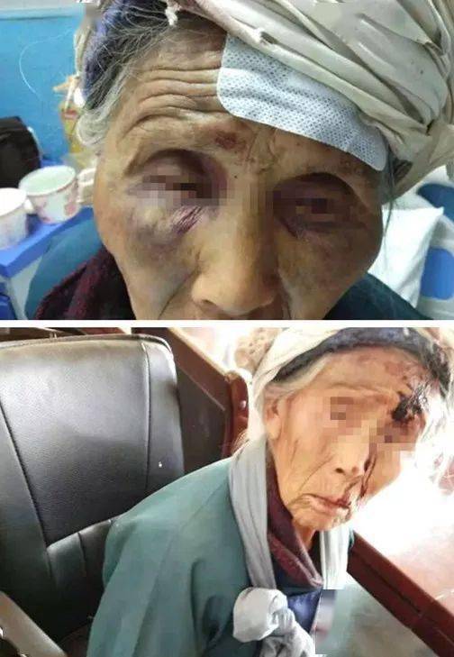 70岁老兵被当街殴打:上战场都没倒下,被人渣打倒了……_老人