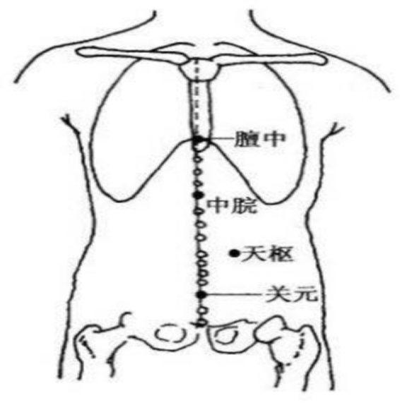 护理荟 重症胰腺炎的中医特色护理