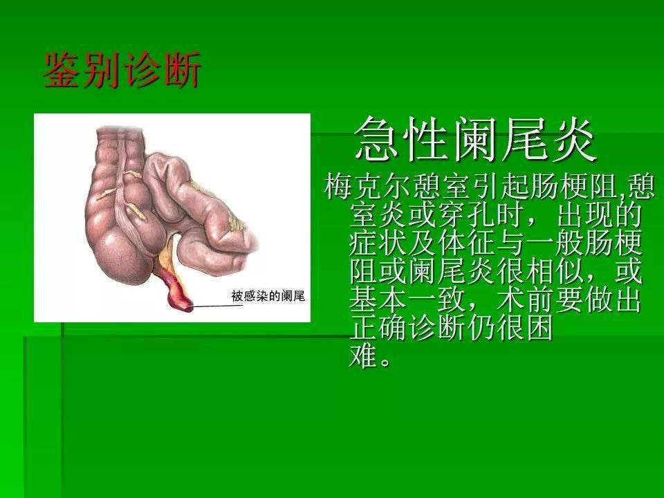 梅格尔憩室图片