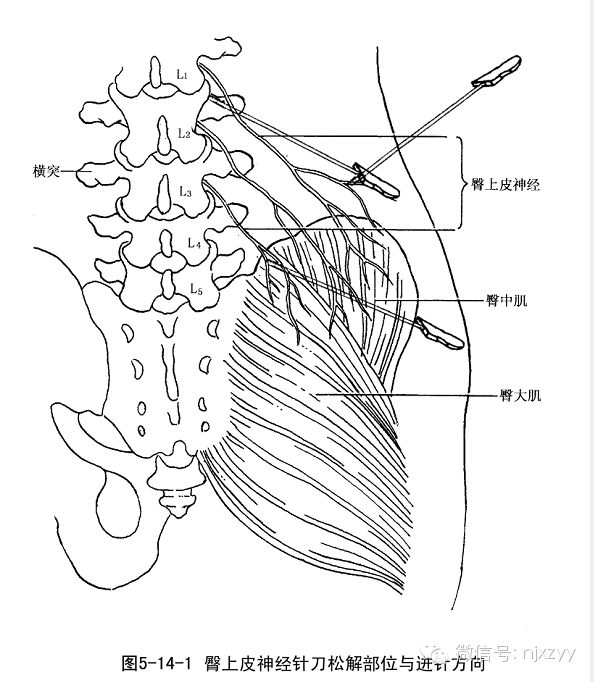 臀部血管神经分布图片