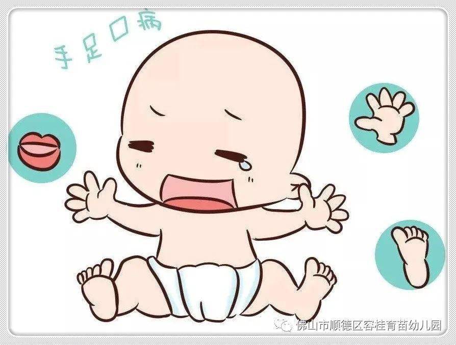 幼儿预防手足口病知识科普