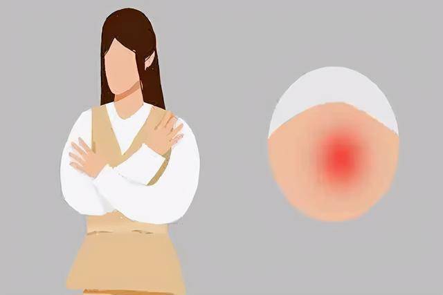 乳腺癌發病率高若能在早期發現生存率高醫生抓住3個信號