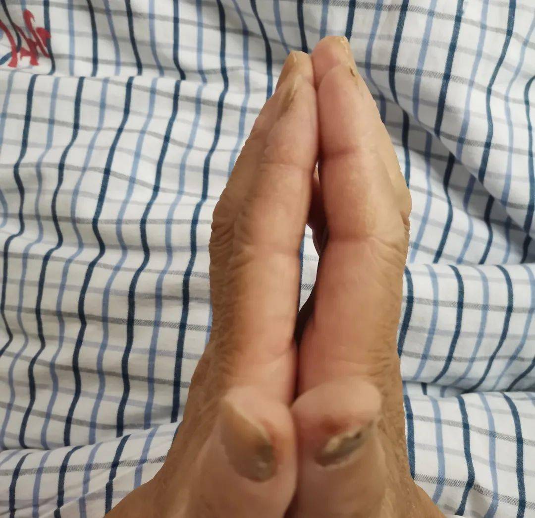 皲裂明显,然而虽说陈阿姨是一直干农活,但是这双手更像是机械工人