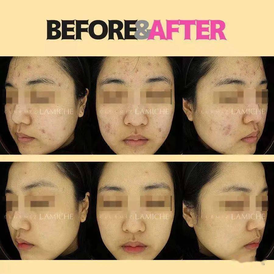 【皮肤变好,一次见效】19年老牌韩国皮肤科,11月私人定制等你来!