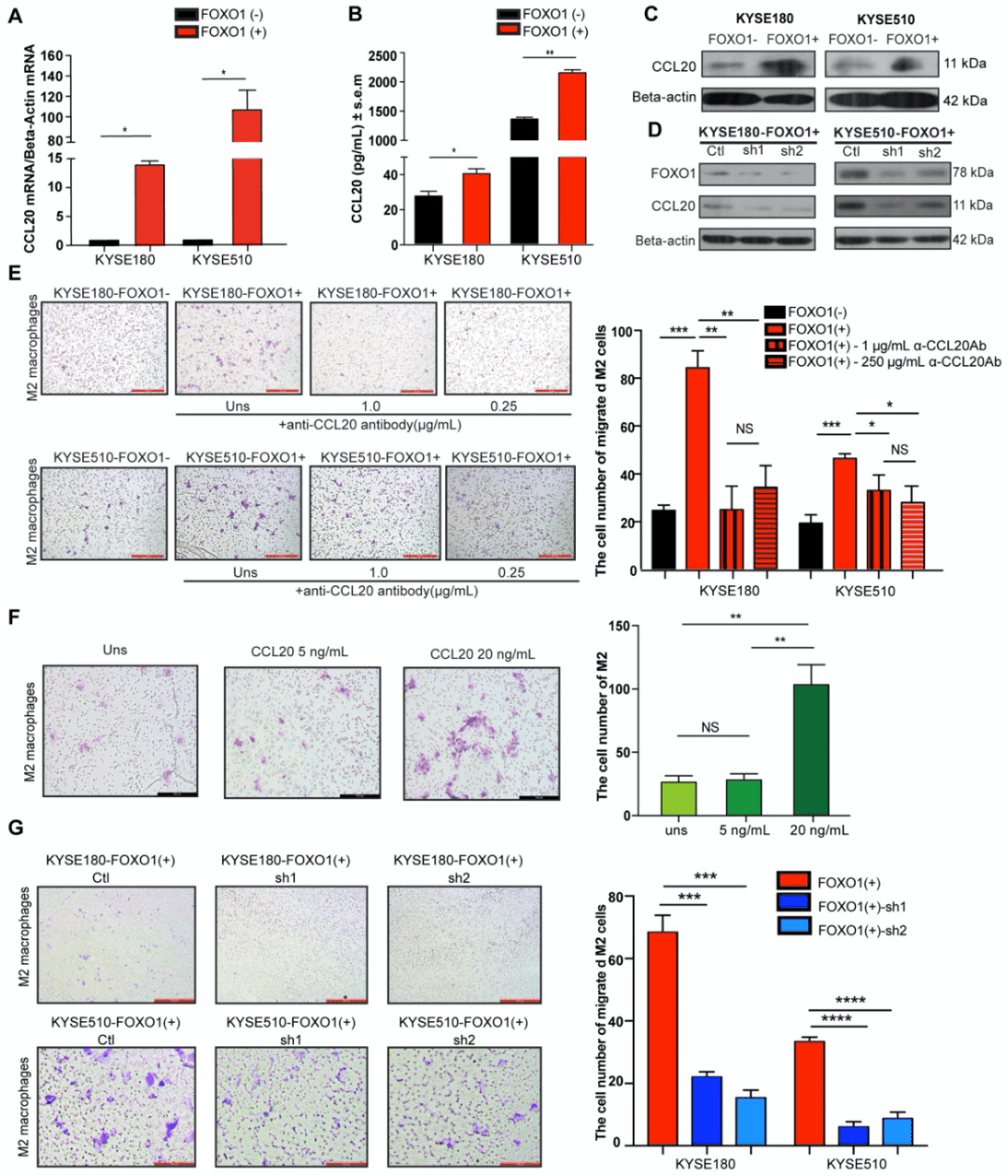 【进展】foxo1促进食管鳞癌中m2巨噬细胞浸润和进展