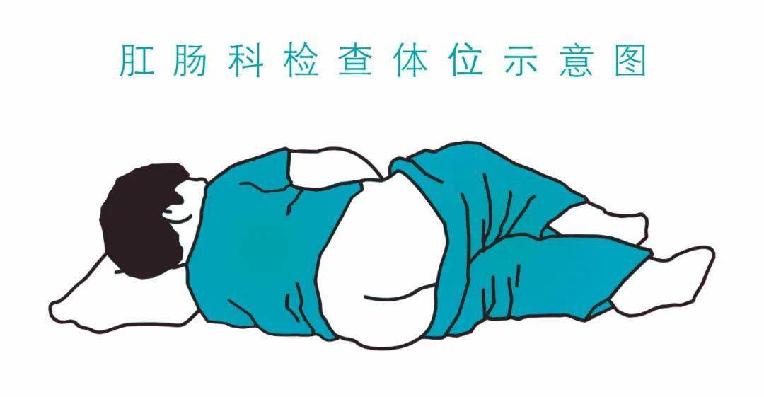 去肛肠科看病,你需要知道的几件事!_检查