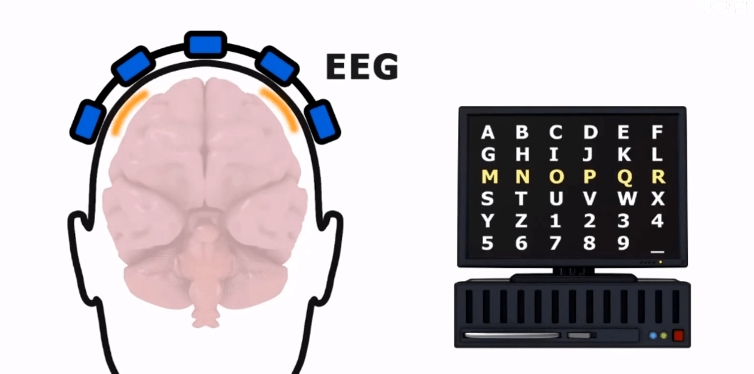 rd技术贴|脑机接口微科普