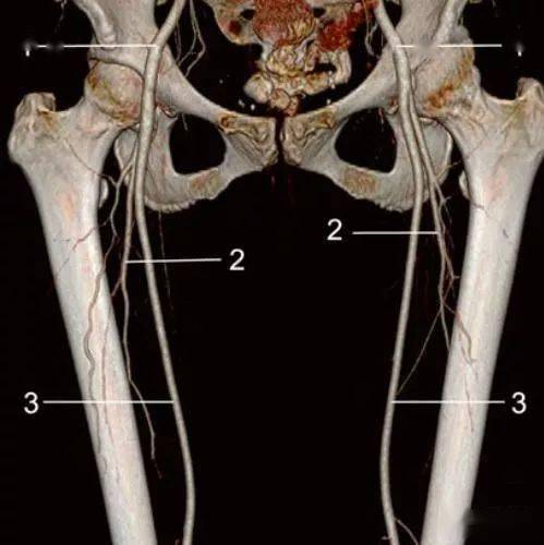 下肢动脉解剖图谱CT图片