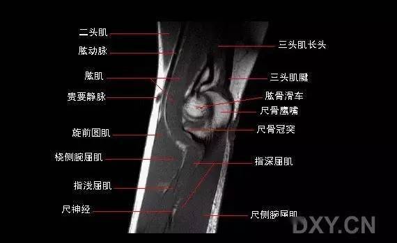 肘關節mri圖譜超全整理及常見病變mr診斷