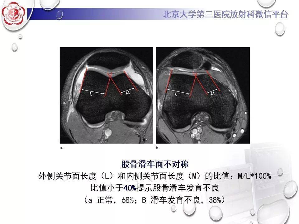 北京股骨头医院怎么样