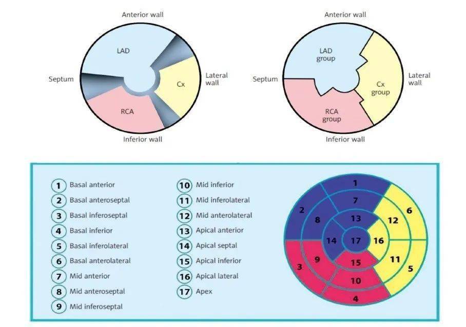 17节段分段法以及其相应的冠脉供血范围该患者的sss,sds及tpd评分4