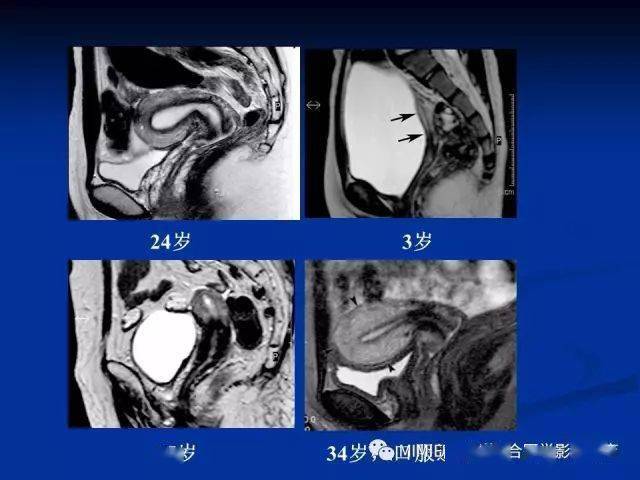 男女性生殖系统的结构及功能(男女性生殖系统的结构及功能特点)-第2张图片-鲸幼网