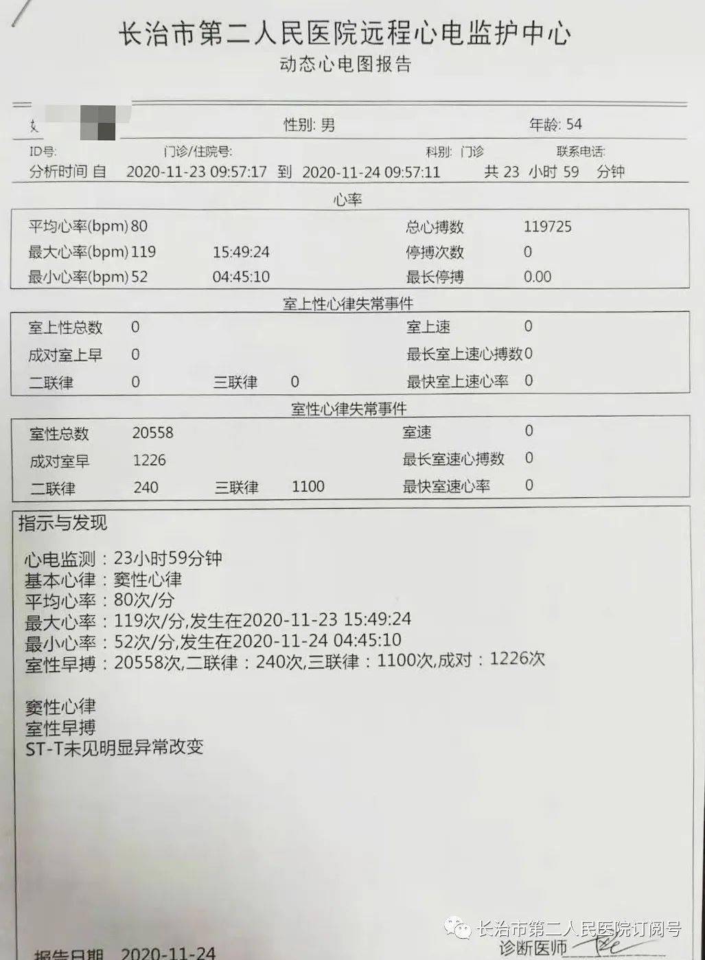 入院体表心电图提示有室性早搏近日,长治二院心脏中心电生理团队完成