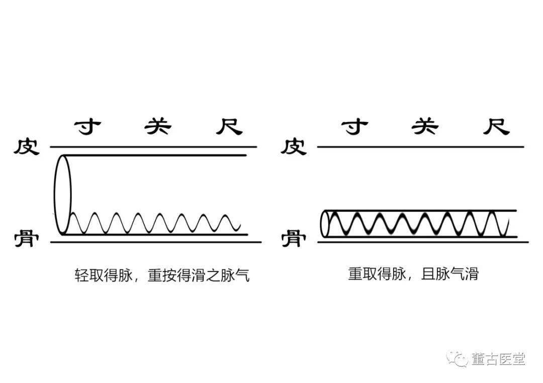 《图解脉诊》网络课问题答疑二 如何感受滑脉