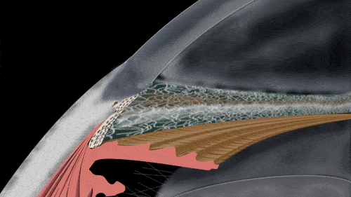 护眼干货万万没想到隐藏的视力杀手竟然是它
